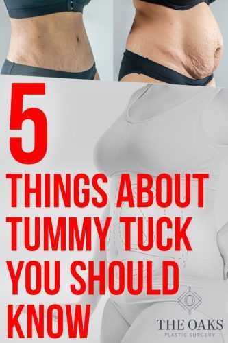 Tummy Tuck Insurance Coverage – Find Affordable Policies