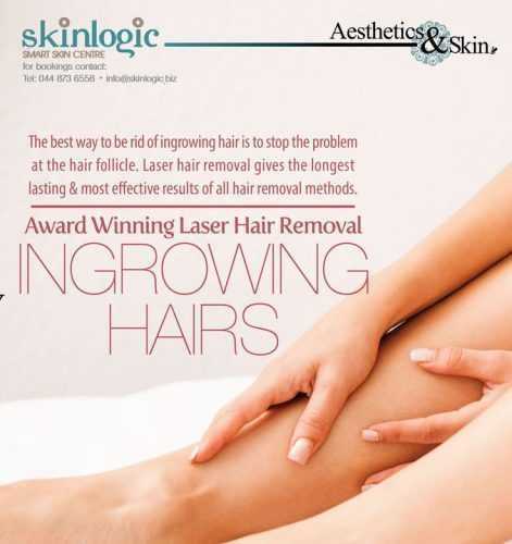 laser-hair-removal-pcos-what-you-need-to-know-livsmooth